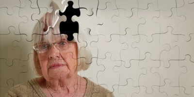 La ciencia le da pelea al Alzhéimer